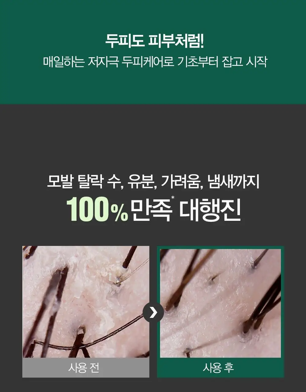 [변우석 Pick]다슈 안티헤어로스 허브 헤어토닉 150ml (탈모증상완화도움 기능성) 상세페이지 6